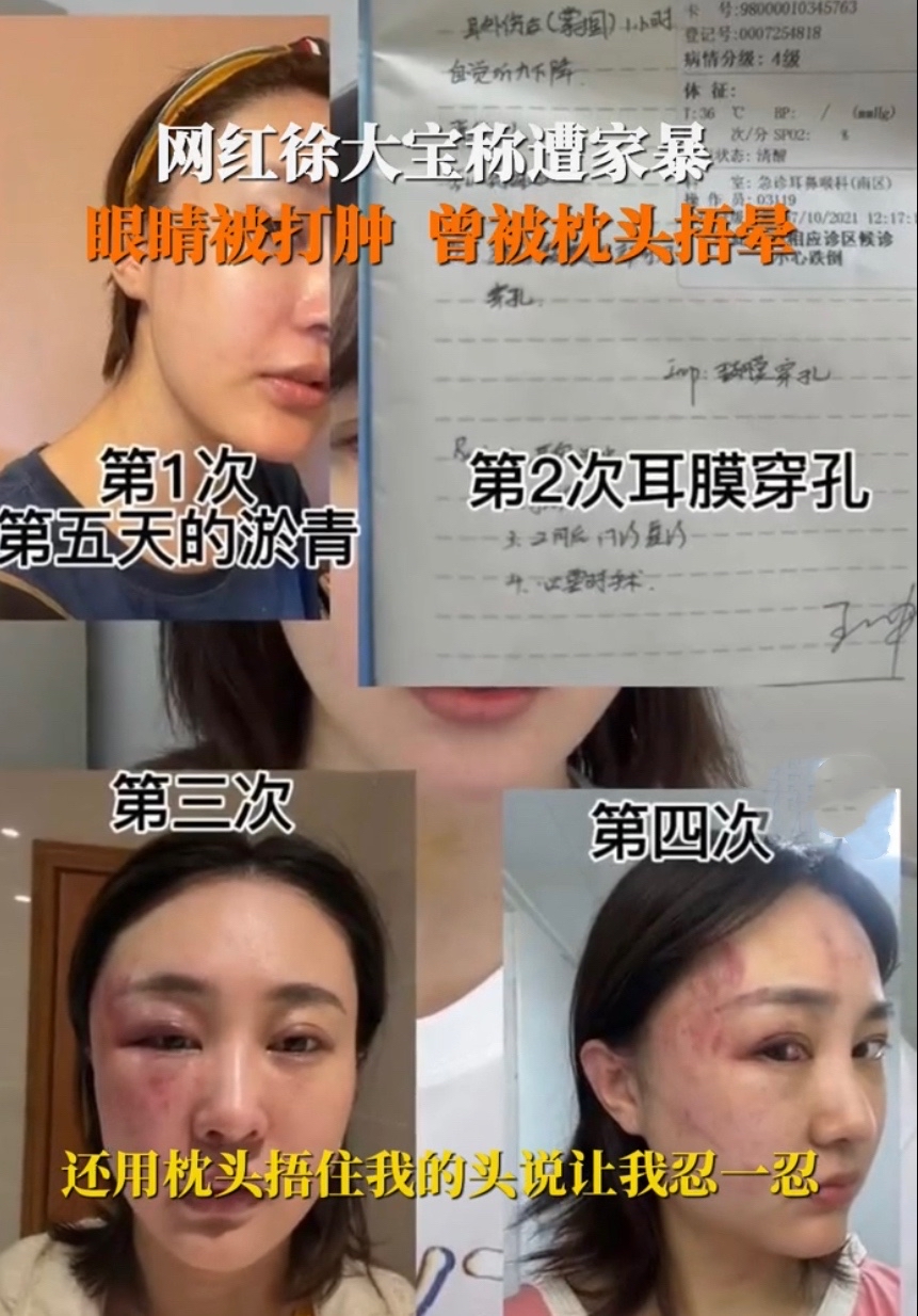 女主播虚构被家暴,直播卖惨求刷礼物,3个月捞金700多万,直播被女主播家暴怎么办